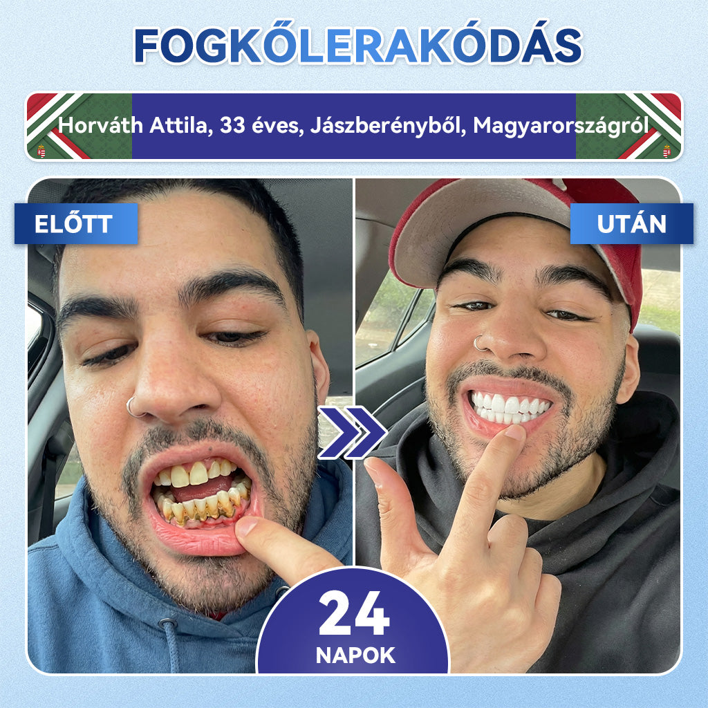 𝐺𝑙𝑖𝑚𝑚𝑒𝑟𝑙𝑦® 𝑇𝑖𝑑𝑒𝑔𝑙𝑢𝑠𝑖𝑏 𝑓𝑜𝑔- é𝑠 í𝑛𝑦𝑗𝑎𝑣í𝑡ó 𝑔𝑦𝑜𝑟𝑠𝑎𝑛 𝑜𝑙𝑑ó𝑑ó 𝑠𝑧á𝑗𝑐𝑠í𝑘𝑜𝑘   口溶贴片 1.0匈牙利