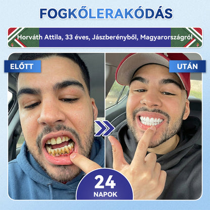 𝐺𝑙𝑖𝑚𝑚𝑒𝑟𝑙𝑦® 𝑇𝑖𝑑𝑒𝑔𝑙𝑢𝑠𝑖𝑏 𝑓𝑜𝑔- é𝑠 í𝑛𝑦𝑗𝑎𝑣í𝑡ó 𝑔𝑦𝑜𝑟𝑠𝑎𝑛 𝑜𝑙𝑑ó𝑑ó 𝑠𝑧á𝑗𝑐𝑠í𝑘𝑜𝑘   口溶贴片 1.0匈牙利