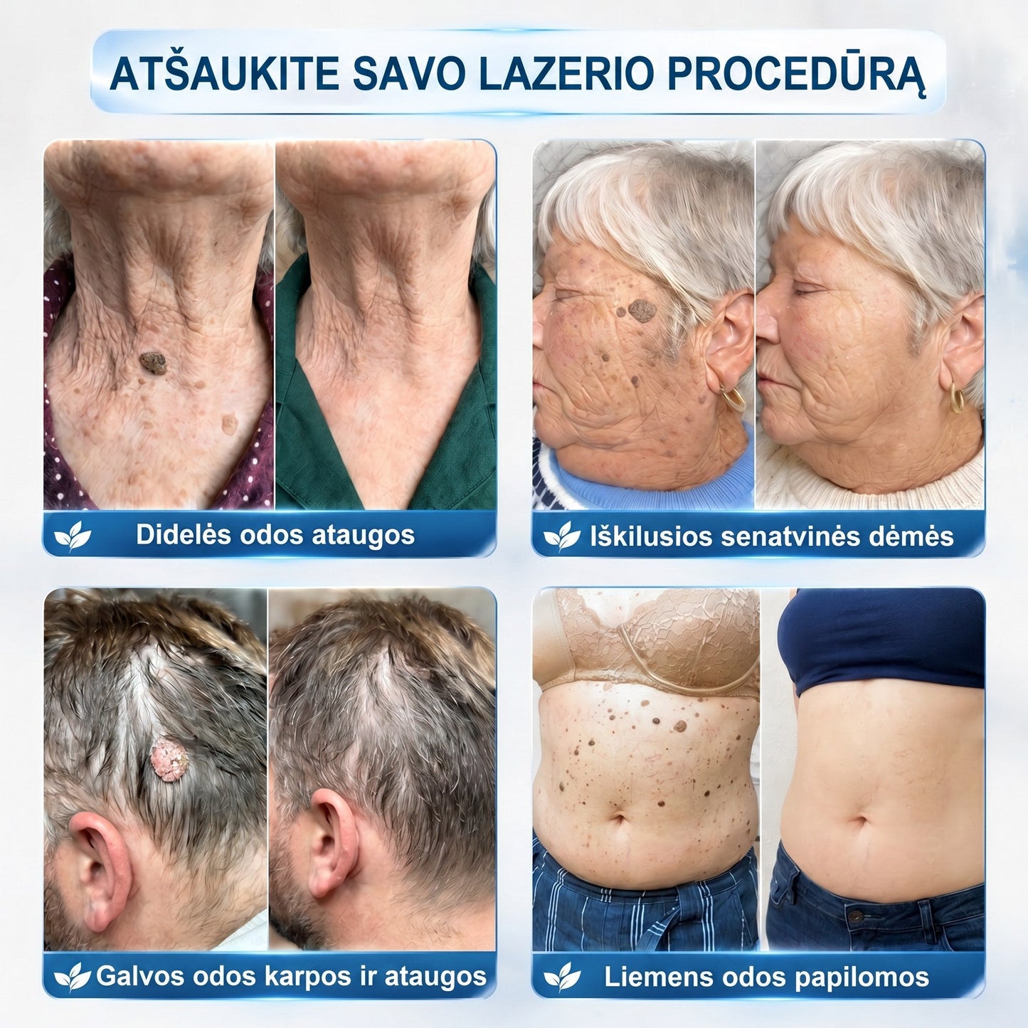 🍟🍟𝐏i𝐜𝐝o® 𝟕 𝐃𝐢𝐞𝐧𝐨𝐬 𝐏𝐢𝐠𝐦𝐞𝐧𝐭𝐢𝐧𝐢ų 𝐃ė𝐦𝐢ų 𝐈𝐫 𝐑𝐚𝐧𝐝ų Š𝐚𝐥𝐢𝐧𝐢𝐦𝐚𝐬 𝐑𝐚š𝐢𝐤𝐥𝐢𝐬(𝐵𝑒 𝑠𝑘𝑎𝑢𝑠𝑚𝑜, 𝑏𝑒 𝑟𝑎𝑛𝑑ų – 𝑟𝑢𝑡𝑢𝑙𝑖𝑛𝑖𝑠 𝑎𝑝𝑙𝑖𝑘𝑎𝑡𝑜𝑟𝑖𝑢𝑠)